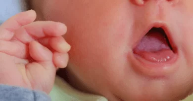 Lip Tie em bebês: o que os pais precisam saber